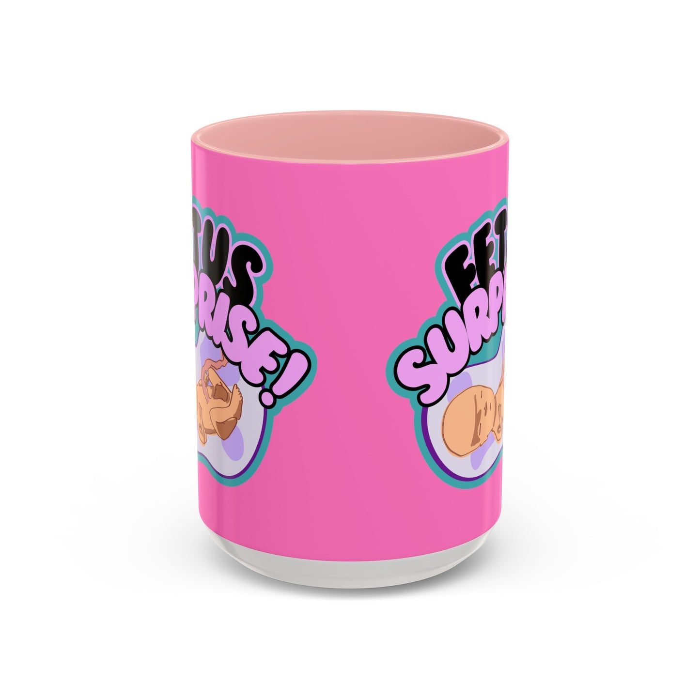 Fetus Surprise! Mug (11, 15oz)